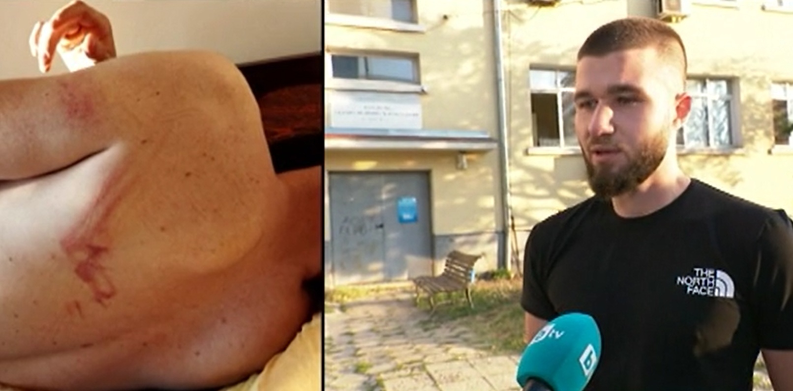 Мъж от Козлодуй се оплака от полицейско насилие: Петима полицаи ме биха с палка и ме унижаваха