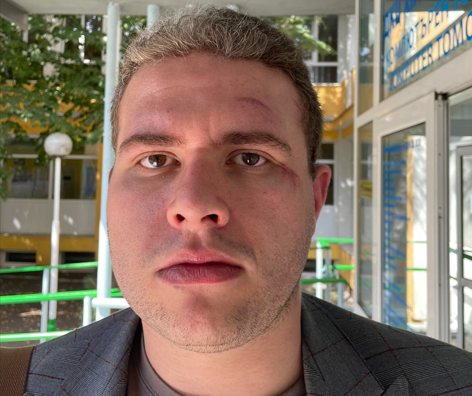 Побой над кандидат за народен представител от БСП в късните часове на Девети септември