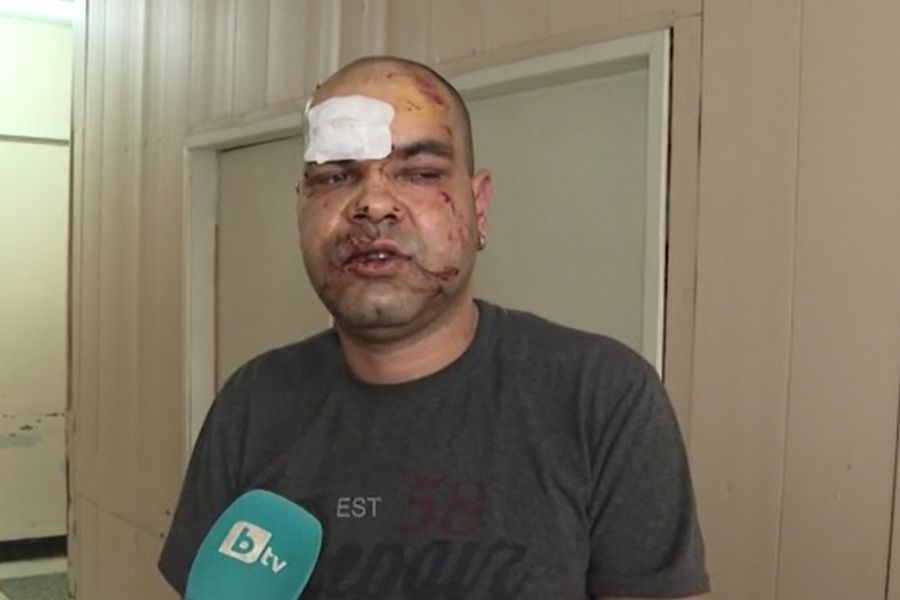 Пуснаха задържания за побоя над медика