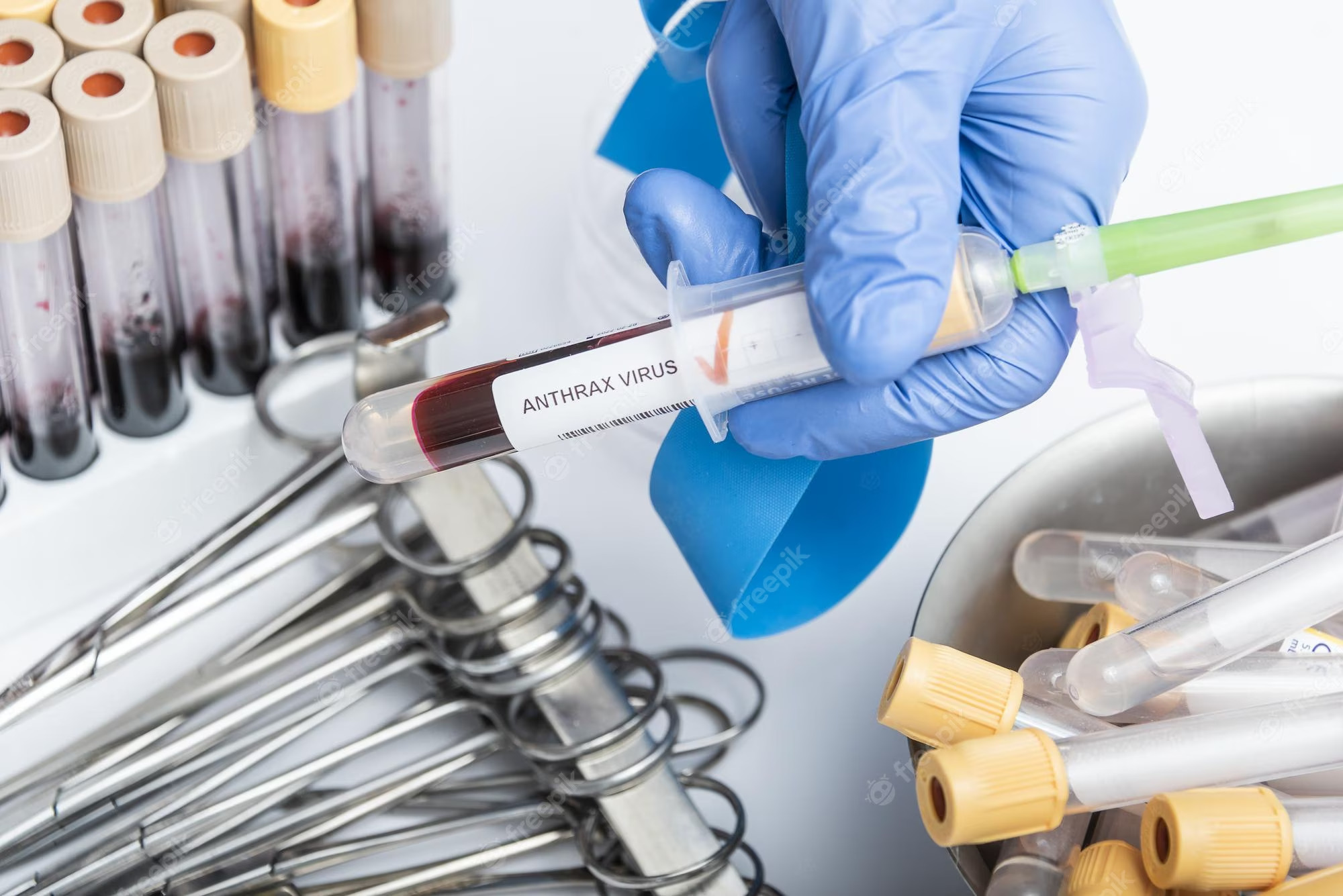 Случай на заразен с антракс е установен в България