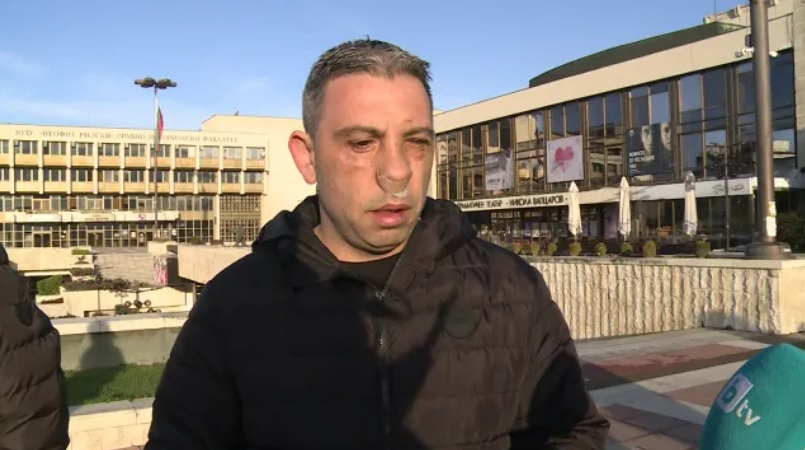 Служител на ГД "Охрана" е със счупен нос след бой пред пиано бар в Благоевград