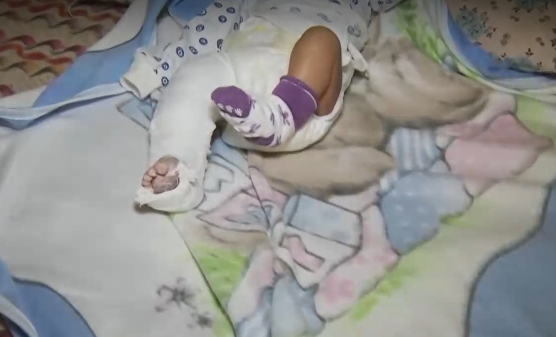 Родители на новородено твърдят, че детето им е пострадало по време на престой в болница