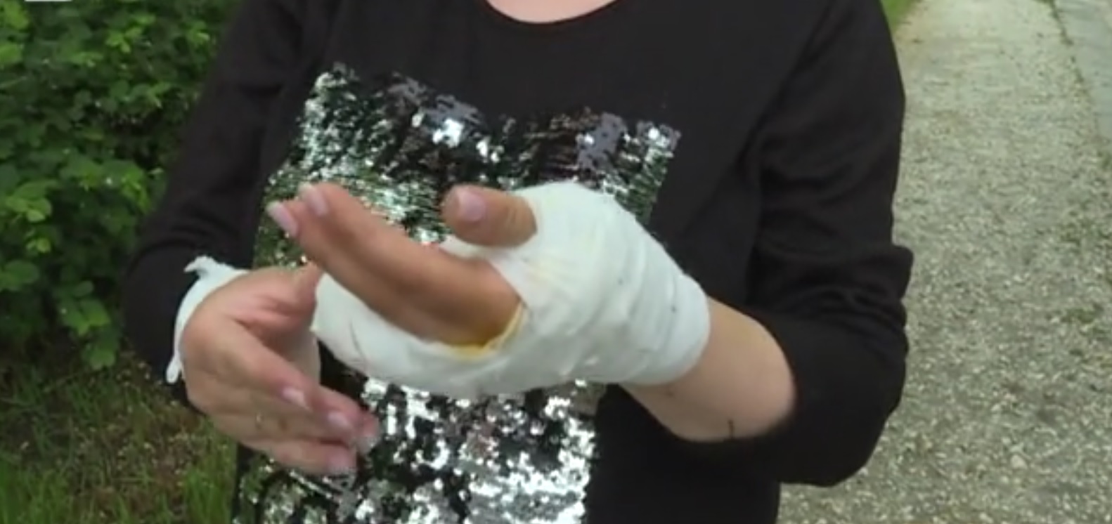 "Изведнъж ме захапа, не съм очаквала": Говори жената, чиито пръсти бяха отхапани от пони