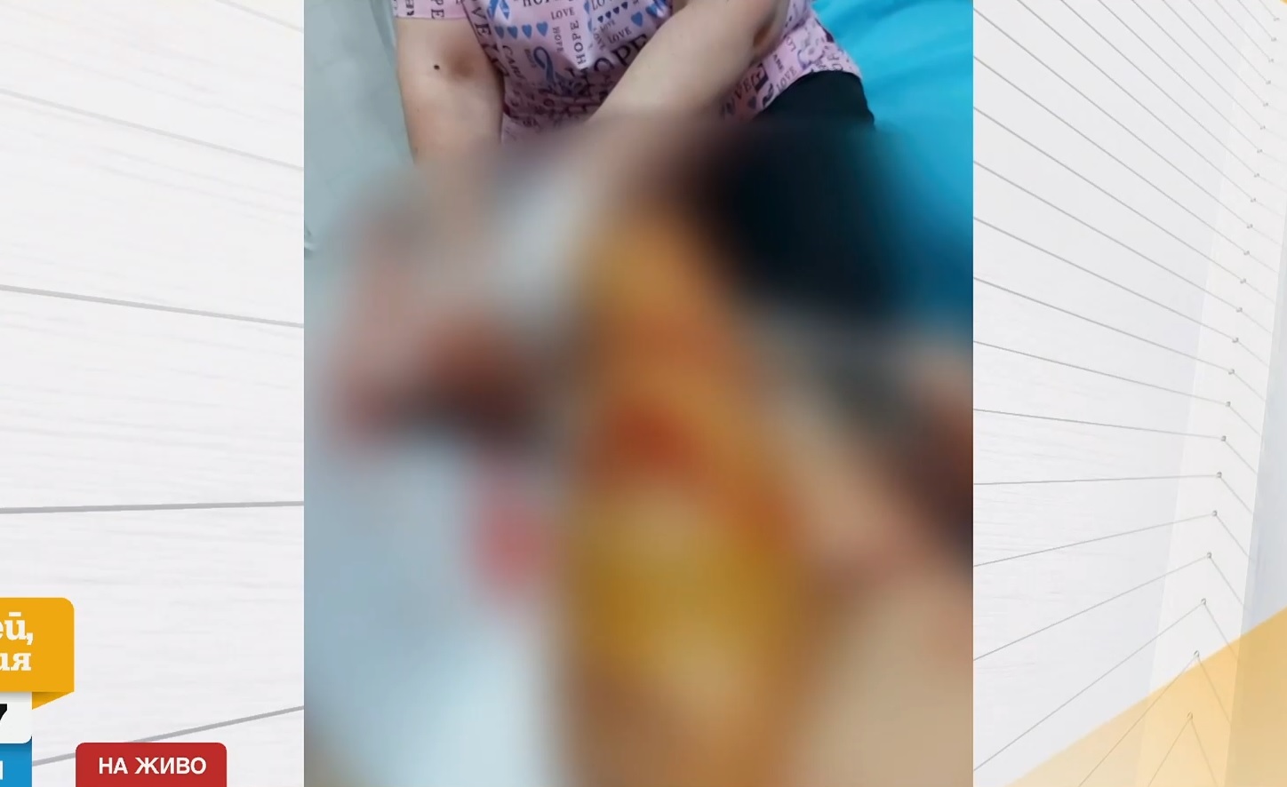 "Тя е затворник в самата себе си, в собствения си кошмар“: Говори майката на обезобразеното момиче от Стара Загора