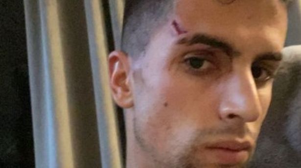 Жоао Кансело разтърси света с признание за две жени