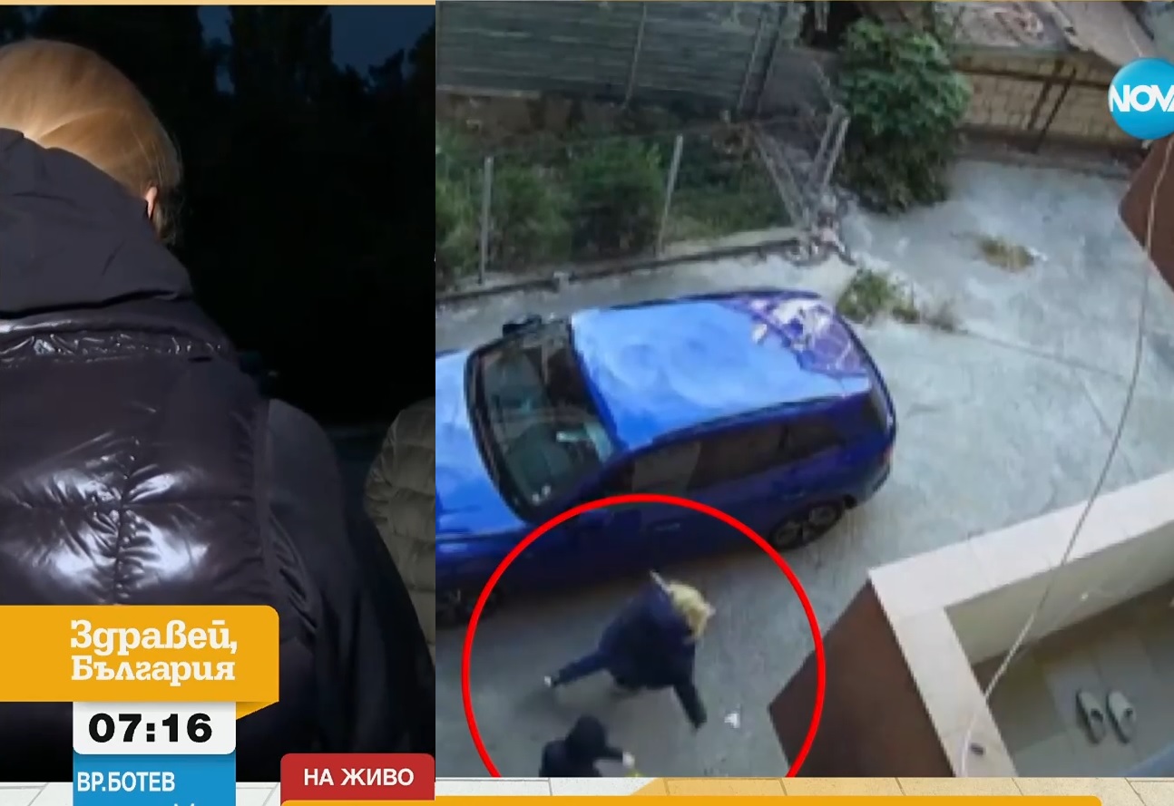 "Пръсна ми окото и останах без пръст": Жена подозира бившия си съпруг в жесток побой с метален прът