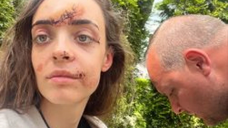Наша колоездачка: Само ударът в дърво спаси живота ми