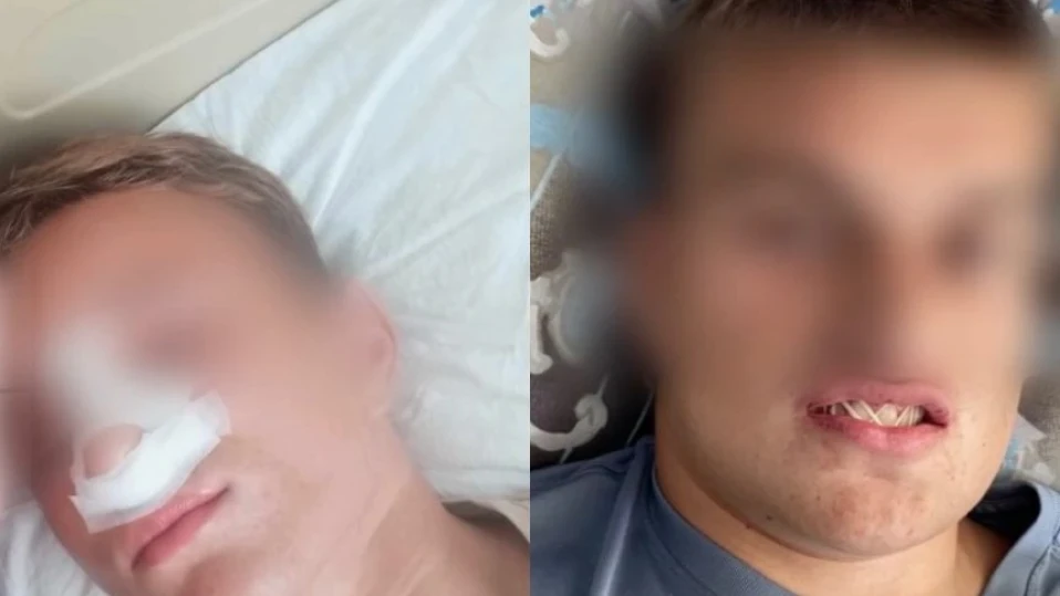 18-годишен преби трима младежи в Айтос