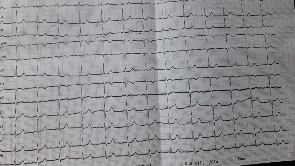 Безплатни кардиологични прегледи в болница "Лозенец"
