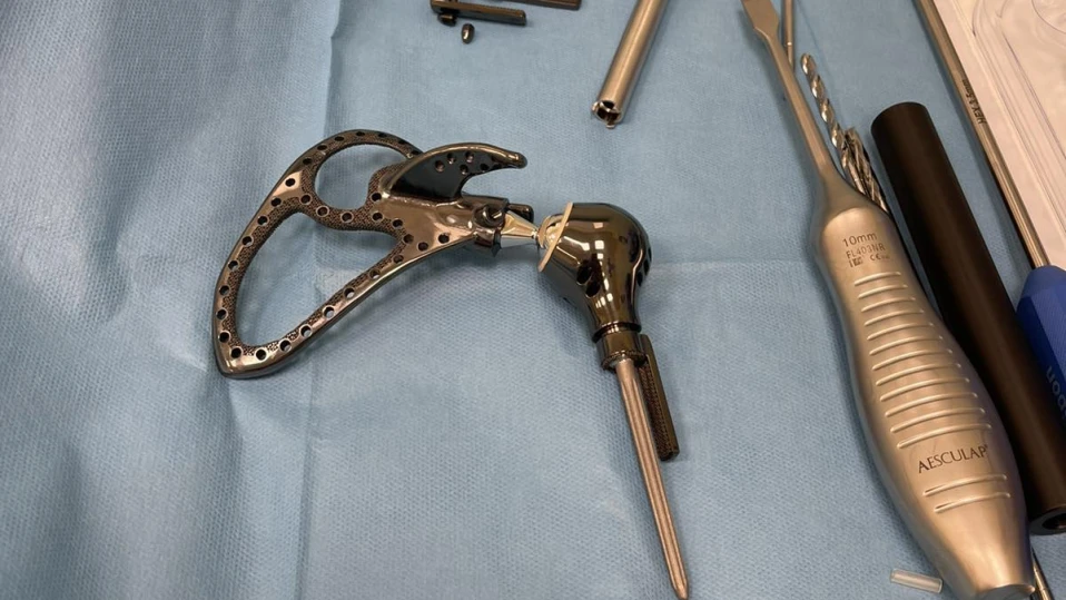 Уникално: Момиче ще движи ръката си с 3D ендопротеза