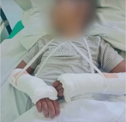 11 годишното момче е с 2 счупени ръцеАдвокатът Бил е провокиранРайонният