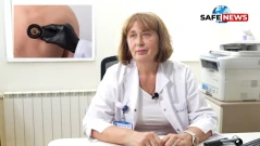 Д-р Цеца Влаева, дерматолог: Хората с много бенки да се преглеждат поне веднъж годишно