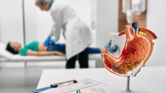 Ракът на дебелото черво все по-често разболява млади хора