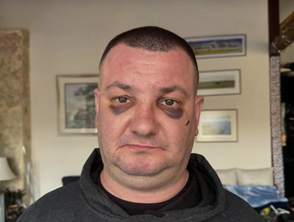 Мъж твърди че е жестоко пребит в дискотека в Троян