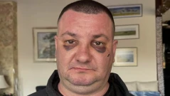 Завързан с белезници и ритан в главата: Мъж твърди, че е жестоко пребит в дискотека в Троян